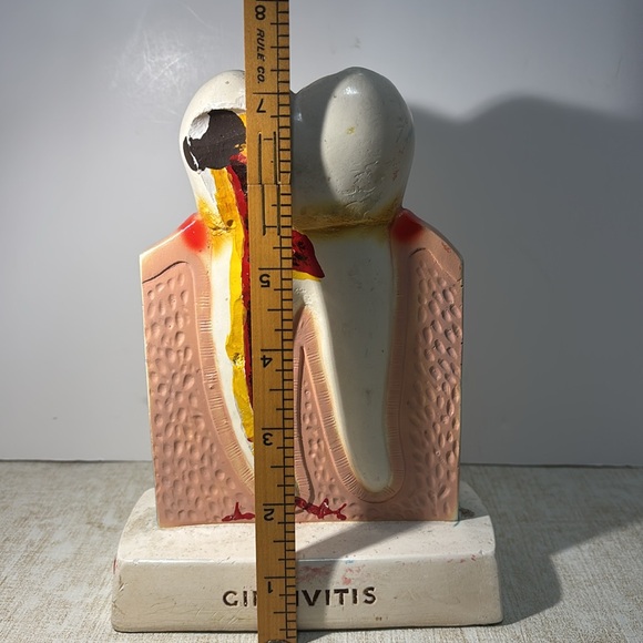 Procter & Gamble Vintage Tooth Model for Gingivitis 1960's (By Crest) - Picture 7 of 8